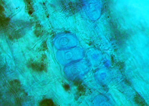 Esporos de Polymyxa graminis em raiz de trigo - Foto: Vânia Bianchin